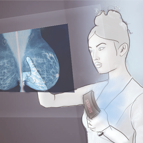 The discovery of early-stage breast cancer without painful and labor-intensive mammography scans.